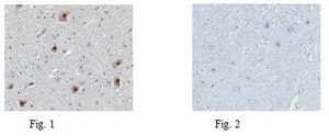 Anti-Tet2 Antibody from rabbit, purified by affinity chromatography