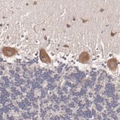 Anti-NF2 antibody produced in rabbit Prestige Antibodies® Powered by Atlas Antibodies, affinity isolated antibody, buffered aqueous glycerol solution