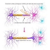 Chondroitinase ABC from Proteus vulgaris lyophilized powder, 0.3-3 units/mg solid