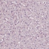Anti-RSPH9 antibody produced in rabbit Prestige Antibodies® Powered by Atlas Antibodies, affinity isolated antibody, buffered aqueous glycerol solution