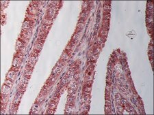 Monoclonal Anti-β-Tubulin I antibody produced in mouse clone SAP.4G5, ascites fluid
