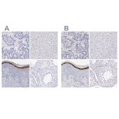 Anti-FLG antibody produced in rabbit Prestige Antibodies® Powered by Atlas Antibodies, affinity isolated antibody, buffered aqueous glycerol solution, ab3