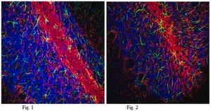 Anti-Neurofilament 200kDa Antibody, clone NE14, Alexa Fluor&#8482; 555 Conjugate clone NE14, from mouse, ALEXA FLUOR&#8482; 555