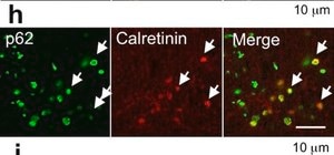 Anti-Calretinin Antibody, clone 6B8.2 clone 6B8.2, Chemicon®, from mouse