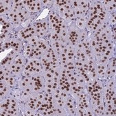 Anti-PARP1 antibody produced in rabbit Prestige Antibodies® Powered by Atlas Antibodies, affinity isolated antibody, buffered aqueous glycerol solution