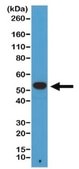 Anti-alpha-Tubulin Antibody, clone RM113 clone RM113, from rabbit