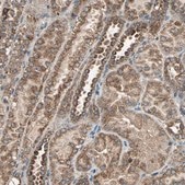 抗POLRMT抗体 ウサギ宿主抗体 Prestige Antibodies® Powered by Atlas Antibodies, affinity isolated antibody, buffered aqueous glycerol solution