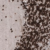 Monoclonal Anti-PARP1 Prestige Antibodies® Powered by Atlas Antibodies, clone CL2209, purified immunoglobulin, buffered aqueous glycerol solution