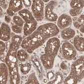 Anti-TFPI antibody produced in rabbit Prestige Antibodies® Powered by Atlas Antibodies, affinity isolated antibody, buffered aqueous glycerol solution