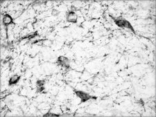 Anti-Dopamine Transporter (N-terminal) antibody produced in rabbit ~1.0 mg/mL, affinity isolated antibody, buffered aqueous solution