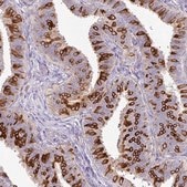 Anti-AGR3 antibody produced in rabbit Prestige Antibodies® Powered by Atlas Antibodies, affinity isolated antibody, buffered aqueous glycerol solution