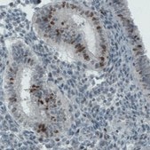 Monoclonal Anti-MKI67 antibody produced in mouse Prestige Antibodies® Powered by Atlas Antibodies, clone CL1234, purified immunoglobulin, buffered aqueous glycerol solution