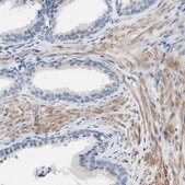 Anti-FDFT1 antibody produced in rabbit affinity isolated antibody, buffered aqueous glycerol solution