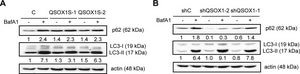 Anti-LC3 antibody produced in rabbit ~1 mg/mL, affinity isolated antibody, buffered aqueous solution