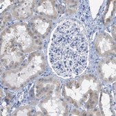 Anti-TEX264 antibody produced in rabbit Prestige Antibodies® Powered by Atlas Antibodies, affinity isolated antibody, buffered aqueous glycerol solution