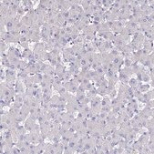 Anti-NME5 antibody produced in rabbit affinity isolated antibody, buffered aqueous glycerol solution