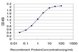 Monoclonal Anti-UPK1B antibody produced in mouse clone 1E1, purified immunoglobulin, buffered aqueous solution