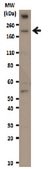 Anticuerpo anti-REST from rabbit, purified by affinity chromatography