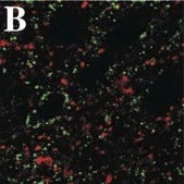 Anti-Polysialic Acid-NCAM Antibody, clone 2-2B ascites fluid, clone 2-2B, Chemicon®