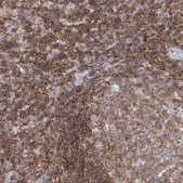 Anti-PSD4 antibody produced in rabbit Prestige Antibodies® Powered by Atlas Antibodies, affinity isolated antibody, buffered aqueous glycerol solution