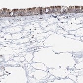Anti-CEP164 antibody produced in rabbit Prestige Antibodies® Powered by Atlas Antibodies, affinity isolated antibody, buffered aqueous glycerol solution