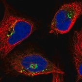 Anti-OSBP antibody produced in rabbit Prestige Antibodies® Powered by Atlas Antibodies, affinity isolated antibody, buffered aqueous glycerol solution