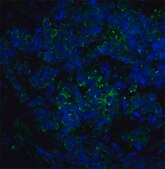 Anti-ST2 antibody produced in rabbit affinity isolated antibody, buffered aqueous solution