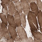 Anti-AKAP1 antibody produced in rabbit Prestige Antibodies® Powered by Atlas Antibodies, affinity isolated antibody, buffered aqueous glycerol solution