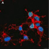 Anti-Olig2 Antibody, clone 1K2 ZooMAb® Rabbit Monoclonal recombinant, expressed in HEK 293 cells