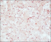 モノクロナール抗α-胎児タンパク質 (AFP) マウス宿主抗体 ascites fluid, clone C3