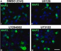 抗MAP2抗体、クローンAP20 clone AP20, Chemicon®, from mouse