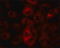 Anti-p62/SQSTM1 antibody produced in rabbit ~1 mg/mL, affinity isolated antibody, buffered aqueous solution
