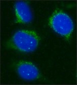 Anti-Sir2 (AS-16) antibody produced in rabbit affinity isolated antibody, buffered aqueous solution