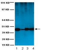 Anti-Actin Antibody, smooth muscle, clone ASM-1 clone ASM-1, Chemicon®, from mouse