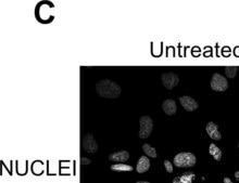 モノクロナール抗フィブロネクチン マウス宿主抗体 clone IST-4, purified from hybridoma cell culture