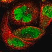 Anti-ZKSCAN1 antibody produced in rabbit Prestige Antibodies® Powered by Atlas Antibodies, affinity isolated antibody, buffered aqueous glycerol solution