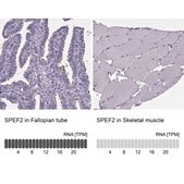 Anti-SPEF2 antibody produced in rabbit Prestige Antibodies® Powered by Atlas Antibodies, affinity isolated antibody, buffered aqueous glycerol solution