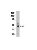Anti-Tau (3-repeat isoform RD3) Antibody, clone 8E6/C11 culture supernatant, clone 8E6/C11, Upstate®