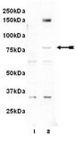 Anti-phospho-LIMK 1/2 (Tyr507/Thr508) Antibody Upstate®, from rabbit