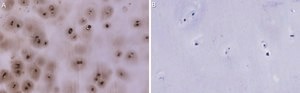 Anti-Aggrecan Antibody, clone 4B10 ZooMAb® Rabbit Monoclonal recombinant, expressed in HEK 293 cells