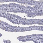 Anti-CDHR3 antibody produced in rabbit Prestige Antibodies® Powered by Atlas Antibodies, affinity isolated antibody, buffered aqueous glycerol solution