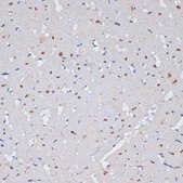 Anti-PARP1 antibody produced in rabbit
