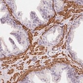 Anti-GPX8 antibody produced in rabbit Prestige Antibodies® Powered by Atlas Antibodies, affinity isolated antibody, buffered aqueous glycerol solution
