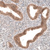 Monoclonal Anti-PIK3CA antibody produced in mouse Prestige Antibodies® Powered by Atlas Antibodies, clone CL8347, purified immunoglobulin, buffered aqueous glycerol solution