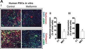 Anti-Actin, α-Smooth Muscle - Cy3™ antibody, Mouse monoclonal clone 1A4, purified from hybridoma cell culture