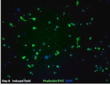 BLaER1 Human B-cell Precursor Leukemia Cell Line BLaER1 human B-cell precursor leukemia cell line may be transdifferentiated and used to model human monocytes.