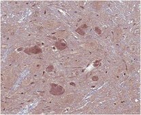 Anti-GABA Antibody from rabbit, purified by affinity chromatography