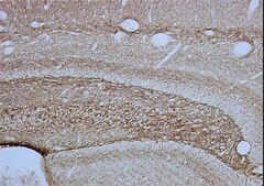 Anti-Neurofilament 200 kDa Antibody, clone RT97 clone RT97, Chemicon®, from mouse