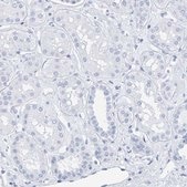 Anti-SFTPC antibody produced in rabbit Prestige Antibodies® Powered by Atlas Antibodies, affinity isolated antibody, buffered aqueous glycerol solution, Ab1