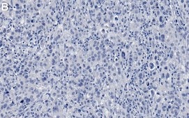 Anti-PTEN Antibody, clone 6H2.1 ZooMAb® Mouse Monoclonal recombinant, expressed in HEK 293 cells